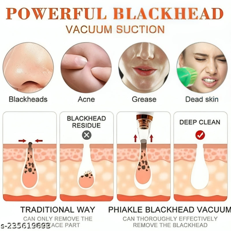 Multi-Function Blackhead Remover – Deep Pore Suction Cleaner (100g)
