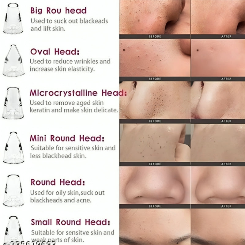 Multi-Function Blackhead Remover – Deep Pore Suction Cleaner (100g)